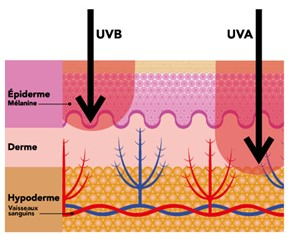Impact des UVB et des UVA dans la peau